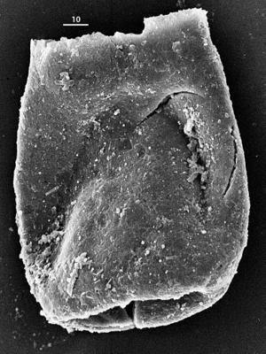 <i><i>Eisenackitina causiata</i></i><br />Aizpute 41 borehole, 937.50 m, lower Silurian ( 345-23)