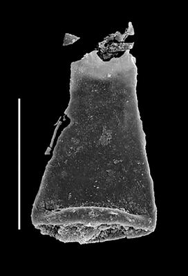 <i><i>Euconochitina</i> | Euconochitina cf. E. conulus (Eisenack)</i><br />Black Knob Ridge Section,  m, Katian ( 862-13)