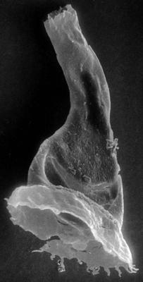 <i><i>Anthochitina primula</i></i><br />Viki borehole, 140.10 m, Adavere Stage ( 272-31)