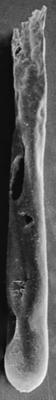 <i><i>Conochitina leptosoma</i></i><br />Ohesaare borehole, 305.45 m, Jaani Stage ( 220-25)