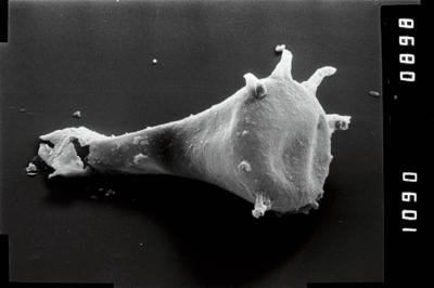 <i><i>Ancyrochitina</i> | Ancyrochitina aff. clathrospinosa</i><br />Vängla trench,  m, Adavere Stage ( 754-1951)