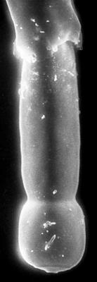 <i><i>Chitinozoa</i> | Chitinozoa gen. et sp. indet.</i><br />Jaagarahu borehole, 35.70 m, Jaani Stage ( 197-22)