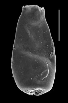 <i><i>Chitinozoa</i> | Conochitina malleus (nomen nudum) Van Grootel, 1990</i><br />Paatsalu 527 borehole, 95.76 m, Llandovery ( 493-11)