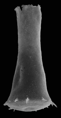 <i><i>Spinachitina multiradiata</i></i><br />Kerguta 565 borehole, 143.76 m, Haljala Stage ( 544-34)