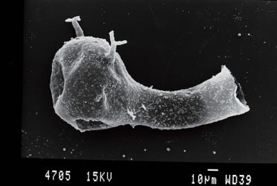 <i><i>Plectochitina</i> | Plectochitina sp.</i><br />Gussev 1 borehole, Kaliningrad oblast, 1393.00 m, Paadla Stage ( 754-64)
