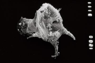 <i><i>Ancyrochitina clathrospinosa</i></i><br />Pulli 2 borehole, 14.20 m, Jaani Stage ( 754-917)