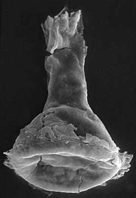 <i><i>Chitinozoa</i> | Clathrochitina aff. clathrata Eisenack, 1959</i><br />Kirikuküla borehole, 11.50 m, Adavere Stage ( 272-57)