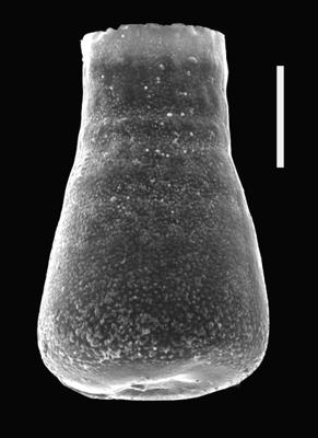 <i><i>Eisenackitina clunensis</i></i><br />Ventspils D-3 borehole, 334.40 m, Přidoli ( 607-60)