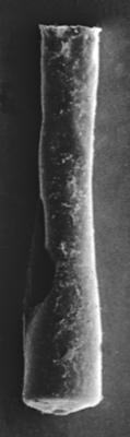 <i><i>Conochitina claviformis</i></i><br />Ruhnu 500 borehole, 392.80 m, Jaagarahu Stage ( 272-73)