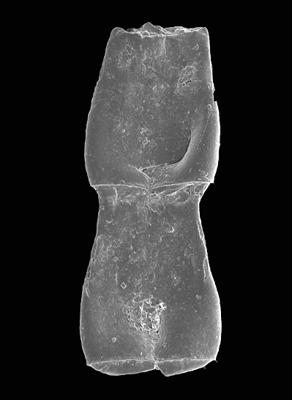 <i><i>Cingulochitina gorstyensis</i></i><br />Pavilosta 51 borehole, 796.00 m, Gorstian ( 576-20)