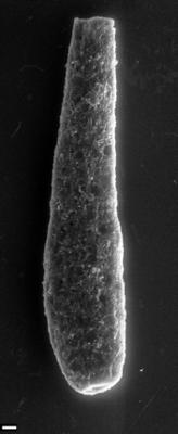 <i><i>Chitinozoa</i> | Kitiiniku laadne mikrofosiil</i><br />Siimika F-328 borehole,  m, Tremadocian ( 1540-6)