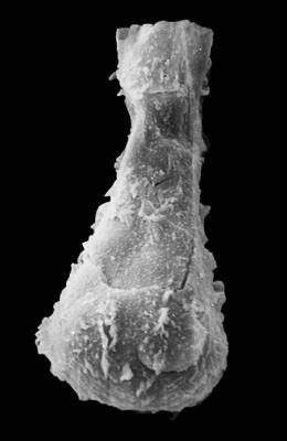 <i><i>Ramochitina spinipes</i></i><br />Pavilosta 51 borehole, 796.00 m, Gorstian ( 576-7)