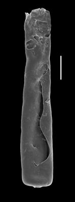 <i><i>Conochitina mamilla</i></i><br />Paatsalu 527 borehole, 66.25 m, Wenlock ( 493-15)