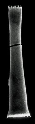 <i><i>Spinachitina coronata</i> | Coronochitina coronata Eisenack, 1931</i><br />Rapla borehole, 49.00 m, Pirgu Stage ( 190-5)