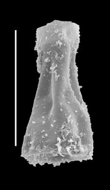 <i><i>Spinachitina</i> | Spinachitina cf. S. cervicornis (Eisenack)</i><br />Black Knob Ridge Section,  m, Katian ( 862-28)