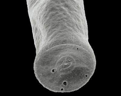 <i><i>Chitinozoa</i> | Conochitina cf. elegans Eisenack, 1931</i><br />Hullo 385 borehole, 25.50 m, Vormsi Stage ( 306-12)