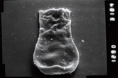 <i><i>Linochitina</i> | Linochitina sp.2</i><br />Nagli 106 borehole, 625.00 m, Adavere Stage ( 754-951)