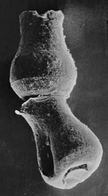 <i><i>Chitinozoa</i> | Linochitina aff. odiosa Laufeld, 1974</i><br />Ruhnu 500 borehole, 333.00 m, Jaagarahu Stage ( 220-58)