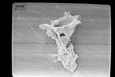 <i><i>Clathrochitina clathrata</i></i><br />Ruhnu 500 borehole, 392.80 m, Jaagarahu Stage ( 754-672)