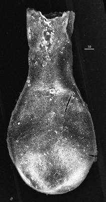 <i><i>Sphaerochitina</i> | Sphaerochitina sp.</i><br />Aizpute 41 borehole, 974.65 m, lower Silurian ( 345-9)