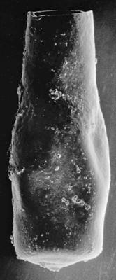 <i><i>Chitinozoa</i> | Conochitina cf. tuba Eisenack, 1932</i><br />Ohesaare borehole, 305.40 m, Jaani Stage ( 220-28)