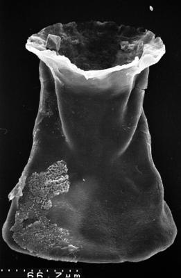 <i><i>Chitinozoa</i></i><br />,  m,  ( 1532-93)