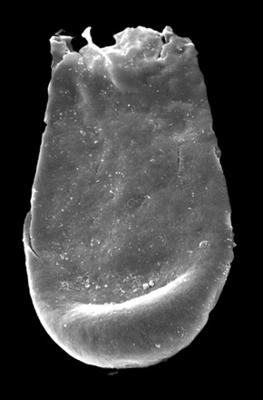 <i><i>Bursachitina</i> | Bursachitina sp. B Loydell et al., 2010</i><br />Kolka 54 borehole, 527.00 m, Jaagarahu Stage ( 546-67)