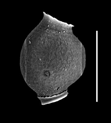 <i><i>Desmochitina juglandiformis</i></i><br />Bliudžiai 150 borehole, 1370.36 m, Haljala Stage ( 726-6)
