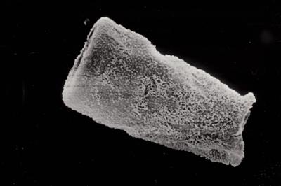 <i><i>Conochitina cribrosa</i></i><br />Ruhnu 500 borehole, 288.15 m, Jaagarahu Stage ( 754-784)