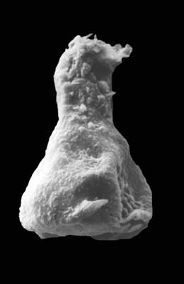 <i><i>Ancyrochitina diabolus</i></i><br />Ohesaare borehole, 112.60 m, Paadla Stage ( 576-9)