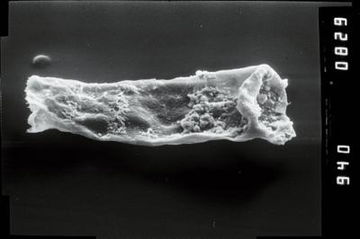 <i><i>Spinachitina fragilis</i> | </i><br />Ohesaare borehole, 446.90 m, Juuru Stage ( 754-1907)