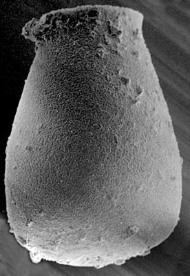 <i><i>Eisenackitina spongiosa</i></i><br />Ohesaare borehole, 260.30 m, Jaagarahu Stage ( 272-103)