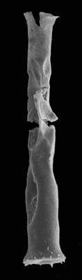 <i><i>Chitinozoa</i> | Belonechitina cf. capitata (Eisenack, 1962)</i><br />Kerguta 565 borehole, 172.65 m, Uhaku Stage ( 544-31)