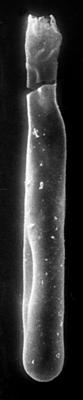 <i><i>Conochitina</i> | Conochitina cf. leptosoma Laufeld, 1974</i><br />Jaagarahu borehole, 35.70 m, Jaani Stage ( 273-26)