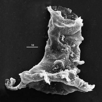<i><i>Plectochitina</i> | Plectochitina cf. pachyderma Laufeld, 1974</i><br />Aizpute 41 borehole, 928.00 m, lower Silurian ( 345-31)
