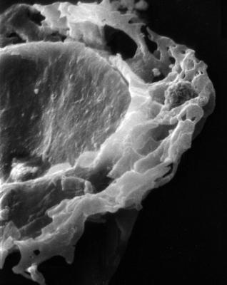<i><i>Anthochitina primula</i></i><br />Viki borehole, 140.10 m, Adavere Stage ( 272-29)