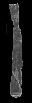 <i><i>Conochitina leptosoma</i></i><br />Paatsalu 527 borehole, 62.22 m, Wenlock ( 493-16)