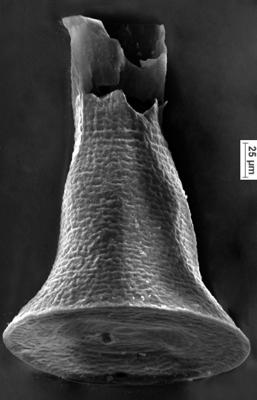 <i><i>Chitinozoa</i> | Cyathochitina cf. campanulaeformis (Eisenack, 1931)</i><br />Ikla borehole, 310.60 m, Adavere Stage ( 350-4)