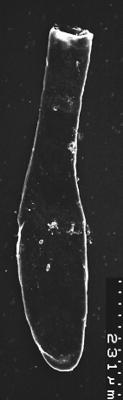 <i><i>Chitinozoa</i> | Lagenochitina destombesii Elaouad-Debbaj</i><br />Varangu stratotype outcrop,  m, Tremadocian ( 1537-10)