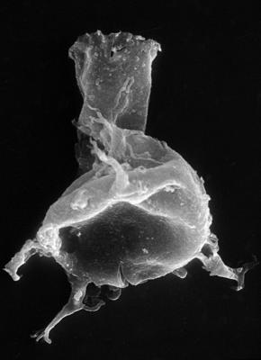 <i><i>Chitinozoa</i> | Ancyrochitina cf. clathrospinosa Eisenack, 1968</i><br />Pulli 1 borehole, 13.20 m, Jaani Stage ( 272-40)
