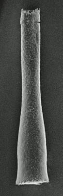 <i><i>Spinachitina coronata</i> | Coronochitina coronata Eisenack, 1931</i><br />Hagudi borehole, 35.50 m, Pirgu Stage ( 306-9)
