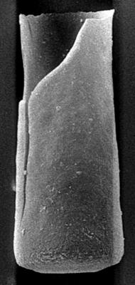 <i><i>Chitinozoa</i> | Conochitina cf. argillophila Laufeld, 1974</i><br />Ohesaare borehole, 159.60 m, Jaagarahu Stage ( 189-23)