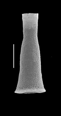 <i><i>Cyathochitina calix</i> | Cyathochitina calix (Eisenack)</i><br />Black Knob Ridge Section,  m, Katian ( 862-21)