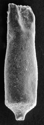<i><i>Chitinozoa</i> | Conochitina cf. flamma Laufeld, 1974</i><br />Ohesaare borehole, 342.20 m, Jaani Stage ( 272-94)