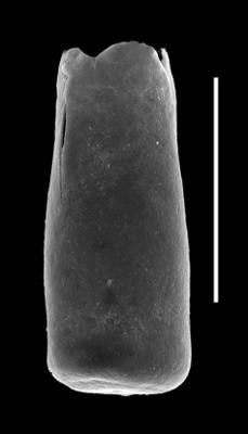 <i><i>Conochitina edjelensis</i></i><br />Paatsalu 527 borehole, 111.50 m, Llandovery ( 493-7)
