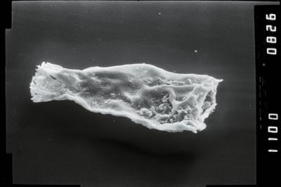 <i><i>Spinachitina fragilis</i> | </i><br />Ohesaare borehole, 446.90 m, Juuru Stage ( 754-1906)