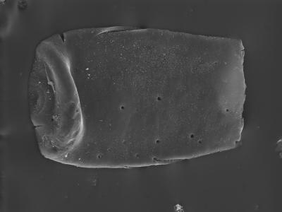 <i><i>Eisenackitina</i> | Eisenackitina sp.</i><br />Ohesaare borehole, 160.20 m, Jaagarahu Stage ( 754-306)