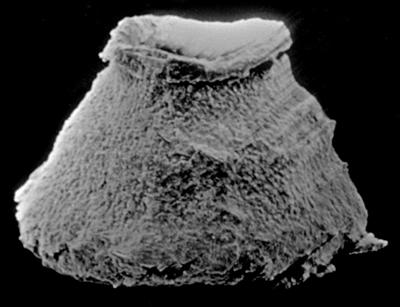 <i><i>Eisenackitina</i> | Eisenackitina sp. 3 Nestor, 1990</i><br />Kolka 54 borehole, 217.50 m, Kaugatuma Stage ( 189-36)