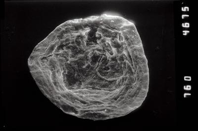 <i><i>Pterochitina macroptera</i></i><br />Pulli 2 borehole, 20.70 m, Jaani Stage ( 754-1111)