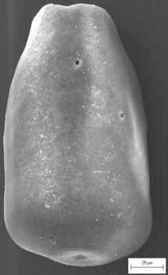 <i><i>Eisenackitina dolioliformis</i></i><br />Staicele 4 borehole, 298.20 m, Adavere Stage ( 754-1372)